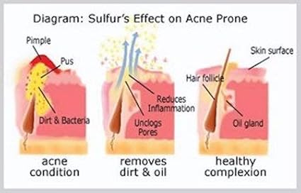 JOESOEF SKIN CARE Sulfur Soap