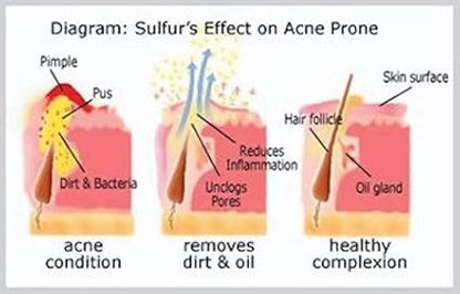 JOESOEF SKIN CARE Sulfur Soap