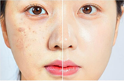 ULTIMATE [Human Stem Cell + (10%) PDRN] Healing Booster Overnight Serum―for Minimizes Wrinkles, Discoloration (10ml x 5vials)