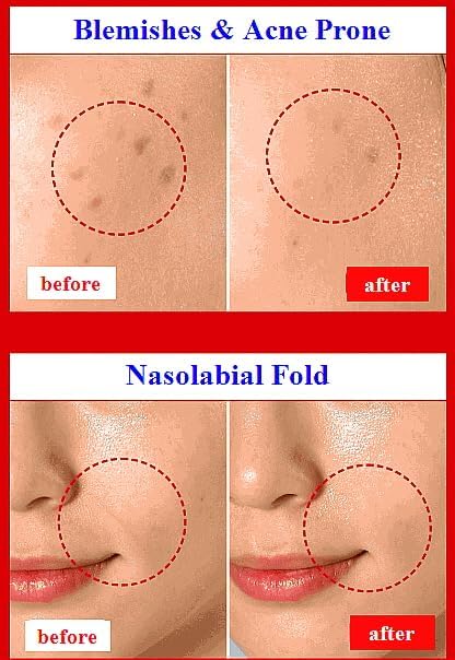 Exceptional Regenerating Serum: Lifts, Volumizes, and Revitalizes with SCM, 5% Volufiline, T1 Collagen, and PHA (30ml, 1oz)