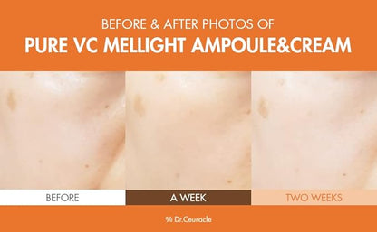 Dr.Ceuracle by leegeehaam Pure VC Mellight Ampoule - Vitamin C Serum for Face, One Week Program for Anti-oxidant, Firm, Clarify, Fade Pigmentation, Skin Radiance (4 Counts (Pack of 1))