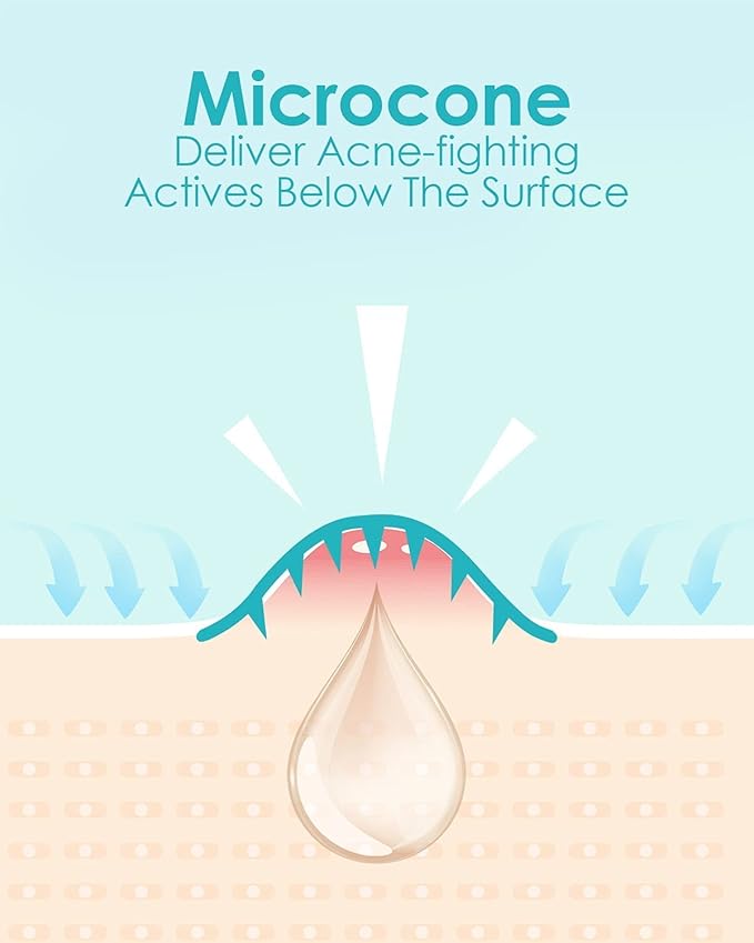 Microdart Acne Patch (54 Patches), Hydrocolloid Pimple Patches, Zit Patches, Pimple Patches for Face Salicylic Acid, Blemish Patches for Early Stage Deep Pimples (54 Count (Pack of 1))