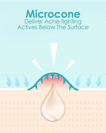 Microdart Acne Patch (54 Patches), Hydrocolloid Pimple Patches, Zit Patches, Pimple Patches for Face Salicylic Acid, Blemish Patches for Early Stage Deep Pimples (54 Count (Pack of 1))