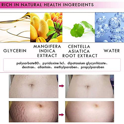 Mango Stretch Marks and Scar Cream,