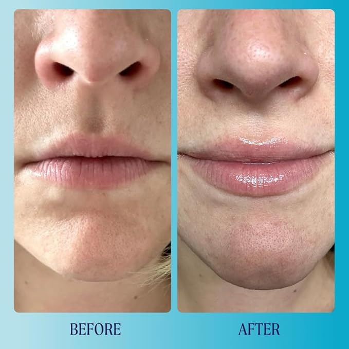 Kinship Supermelt Lip Plumping Jelly Mask