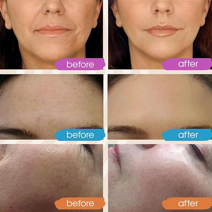 New 2024 Pure Hyaluronic Acid Serum for Face - Hydrating Serum for Women - Hyaluronic Acid Pure Face Serum for Women - Face Serum for Dry Skin with Dark Spots 2oz