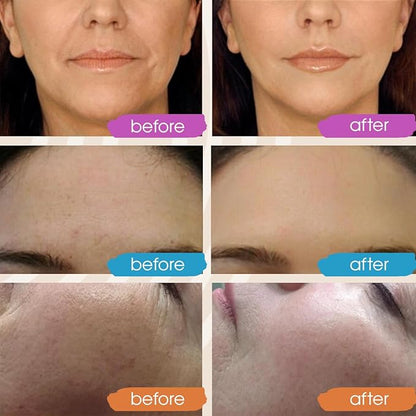 New 2024 Pure Hyaluronic Acid Serum for Face - Hydrating Serum for Women - Hyaluronic Acid Pure Face Serum for Women - Face Serum for Dry Skin with Dark Spots 2oz