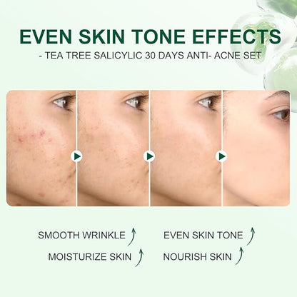 Skincare Mini Kit, Tea Tree Skin Care Sets & Kits, Acne Skincare Set Gifts, Anti Acne Facial Kit Gifts for Women,Cleanser, Toner, Serum, Cream,Oil Control Facial Kit, Airplane Friendly Sizes