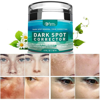 Dark Spot Remover for Face, Hyperpigmentation Treatment, Melasma, Freckle, Sun Spots Removal for All Skin Types Dark Spot Corrector for Men and Women