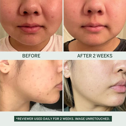 Urban Calm Collection - Fermented Skincare Anti-Aging