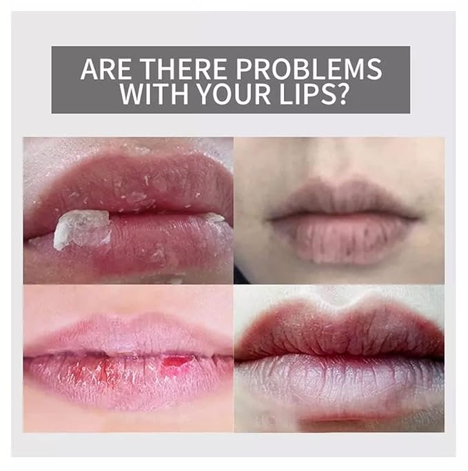 AICHUN BEAUTY Moisturizing Lip Balm Strawberry 50g/1.76oz