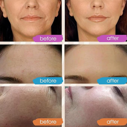 Vitamin C Face Serum, Hydrating Vitamin C Serum for Face with Hyaluronic Acid, Suitable For All Skin Types, Targets the Appearance of Dull Spots 2oz
