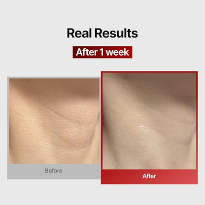 Wrinkle-fit Neck Mask 7EA + Boosting Roller - Neck Wrinkle Patches, Firming and Tightening Korean Deep Collagen Mask - NeckTargeted Mesh Sheet Mask and Face Roller for Lifting Sagging Skin