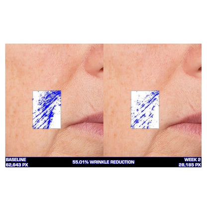 Serious Skincare Ultra-Mare Pure Marine Infusion Facial Serum - Encourages Collagen Production, Cell Turnover and Plumper Skin - Niacinamide - Acid Free - Concentrated 2 oz.