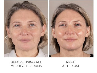 Power Combo Neck & eye Roller Brightening