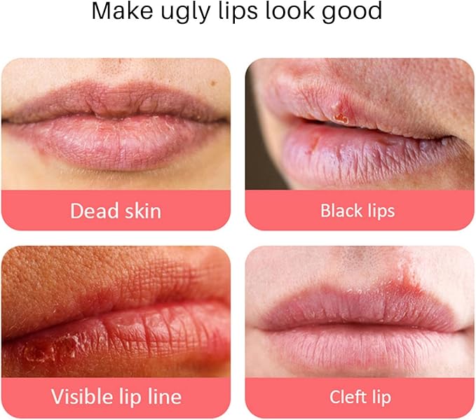 Lip Balm, Remove Dark Lip Portable
