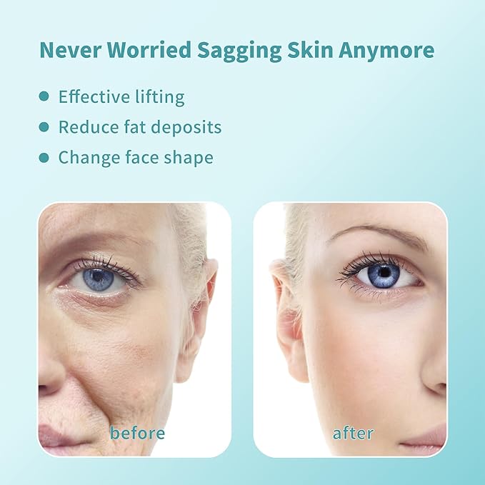 Pdo Threads Pdo Threads Lift for Face Smoothing Wrinkles Pdo Screw Threads Producs Collagen Pdo Lifting Threads Skin Tighten 29g50mm 40Pcs