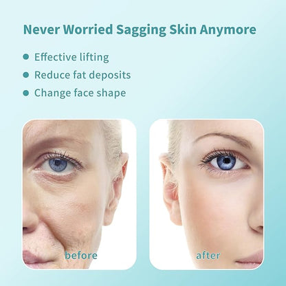 Pdo Threads Pdo Threads Lift for Face Smoothing Wrinkles Pdo Screw Threads Producs Collagen Pdo Lifting Threads Skin Tighten 29g50mm 40Pcs