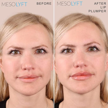 Neck & Lip Plumper Combo Plumping