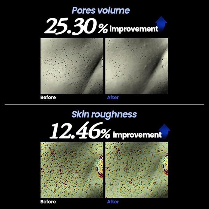 ILSO H-A Shot Booster Serum, Hyal-Spicule Exfoliating Serum, 0.5oz, Improves Skin Texture and Pore Tightening, Moisturizing Formula