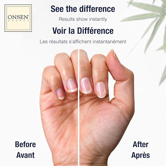 Onsen Secret Nail Care Kit