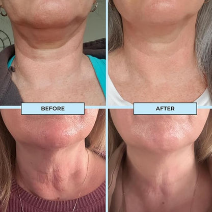 BOOST LAB Edelweiss Neck Firming Serum - Reduce Neck Wrinkles & Neck Ageing - Lifts & Smooths Crepe-Like, Sagging Skin - Paraben Free, Sulphate Free, Fragrance Free - 30 ml (1 fl oz)