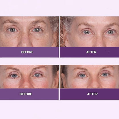 INSTA-TOX Facial Firming Wrinkle Smoothing Serum & Reverse Lift Firming Eye Cream Set - Tightener for Lines, Deep Wrinkles and Pores - Temporary Lift for Face and Eyes - Serious Skincare