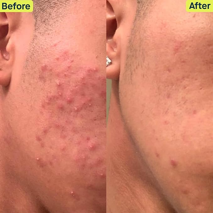 SLMD Skincare by Dr. Pimple Popper