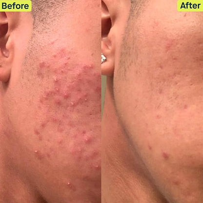 SLMD Skincare by Dr. Pimple Popper