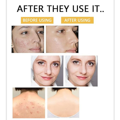 Kojic Acid Body Soap, Face &