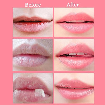 2 Pcs Lip Balm Honey Pot,Honey Wrinkle