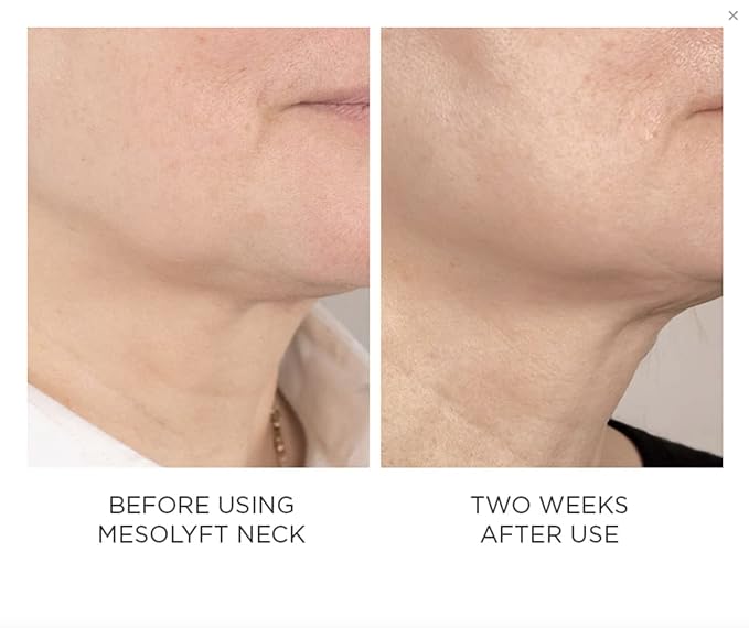 Power Combo Neck & eye Roller Brightening