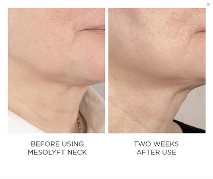 Power Combo Neck & eye Roller Brightening