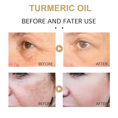 3PCS Turmeric Dark Spot Corrector Serum Oil,Turmeric Repair Face Serum, Natural Turmeric Skin Dark Spot Skin Care Moisturizing Repair Serum,Turmeric Serum for Face & Body(30ml)