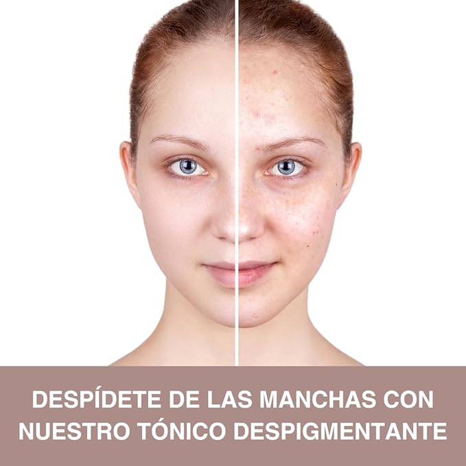 LB Tónico Facial x2 Pack: Despídete de las Manchas y Logra UNA Piel Radiante | Despigmentante LB para un Rostro Luminoso y Uniforme