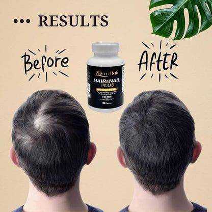 Hair Vitamins for Men - All Natural Vegan Biotin 5000 Mcg Capsules - Hair Supplements for Growth & Thickness - Promote Healthier Hair, Skin, Nails - Hair Growth Supplement Formula