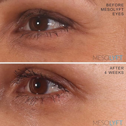 Power Combo Neck & eye Roller Brightening