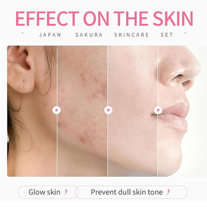 Skin Care Sets for Women/Girls JAPAN SAKURA Beauty Gift Sets Skincare Kit with Cleanser, Serum, Eye Cream, Face Cream Travel Pamper Sets for Women Gifts,Skin Care Sets & Kits