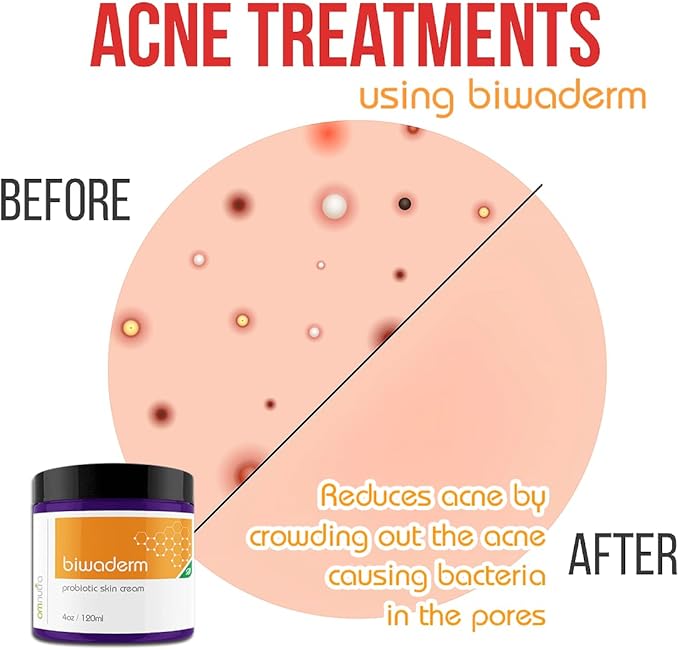 Biwaderm Probiotic Skin Cream - 4OZ