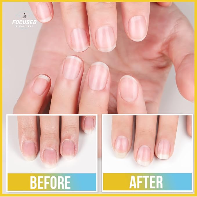 Teenitor Cuticle Remover Cuticle Remover