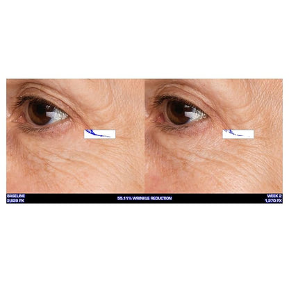 Serious Skincare Ultra-Mare Pure Marine Infusion Facial Serum - Encourages Collagen Production, Cell Turnover and Plumper Skin - Niacinamide - Acid Free - Concentrated 2 oz.