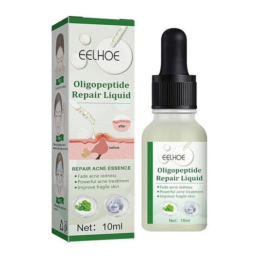 Oligopeptide Stock Solution Face Serum 0.5oz Facial Natural Organic Essence Extract Anti Redness Soothing Remover Blackhead Removal Pimple Acne Prone Spot Removal Erythema Relief Skin Repair