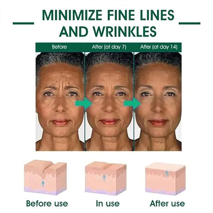Fubsta Skin Firming Rejuvenating Serum, Firming Rejuvenating Serum for All Skin Types, Skin Firming Serum for Face And Neck (1Pcs)