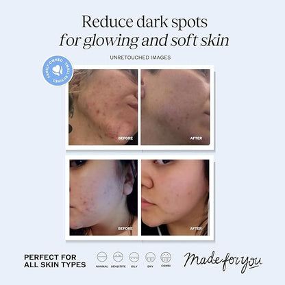 LilyAna Naturals Vitamin C Serum for Face with Hyaluronic Acid and Vitamin E, Anti Aging Serum, Reduces Age Spots and Sun Damage, Promotes Collagen and Elastin (1oz)