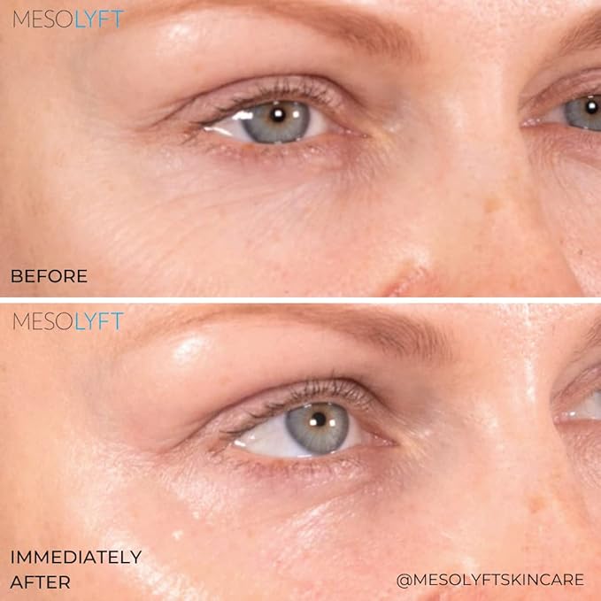 Power Combo Neck & eye Roller Brightening