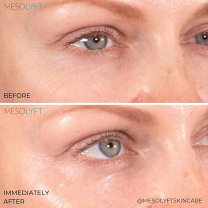 Power Combo Neck & eye Roller Brightening
