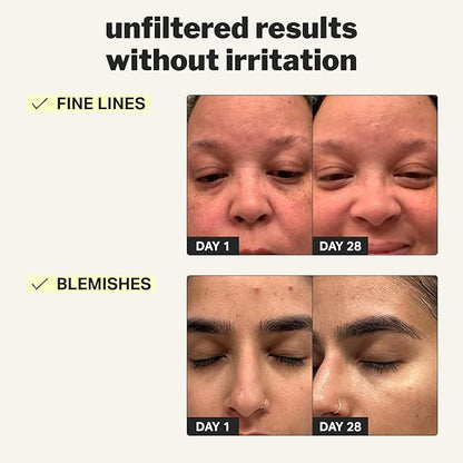 Cocokind Beginner Retinol Gel 0.1%, Improve the Appearance of Fine Lines and Uneven Texture without Irritation, Aloe and Cica to Prevent Dryness, 1 fl oz