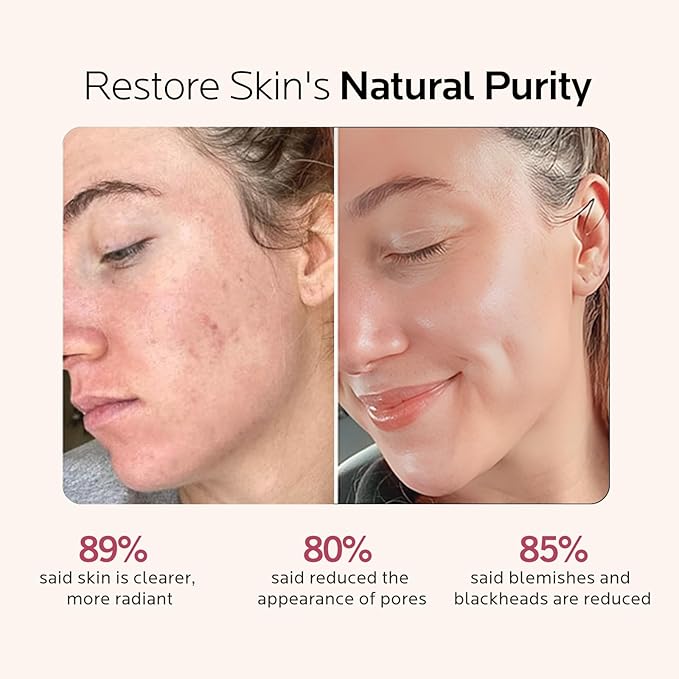 Facial Steamer Self-Care Gift Kit: Nano Ionic Face Steamer Deep Cleaning Unclogs Pores - Home Sauna Spa Humidifier Hot Mist for Women Men Sinus Moisturizing (Rose Gold)