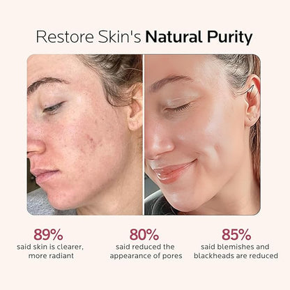 Facial Steamer Self-Care Gift Kit: Nano Ionic Face Steamer Deep Cleaning Unclogs Pores - Humidifier Hot Mist Spa Gifts for Women with 17 Skin Care Tools (Basic Glow Essentials)