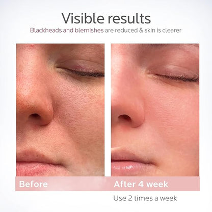 Colorfarm Facial Steamer Nano Ionic: Smart Face Steamer Deep Cleaning Unclogs Pores - Humidifier Hot Mist Home Sauna Spa for Women Men with LCD Display Steam Timer